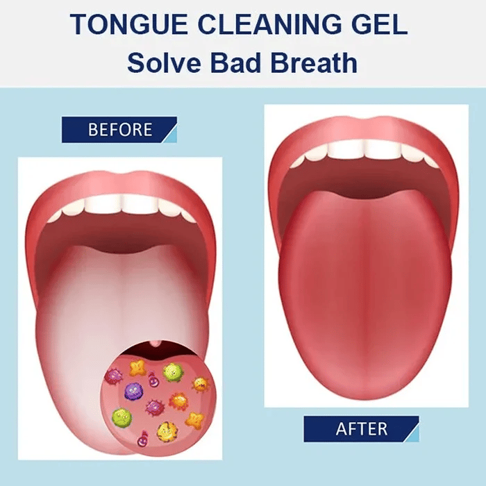 【LAST DAY SALE】Probiotic Tongue Cleaning Gel Set