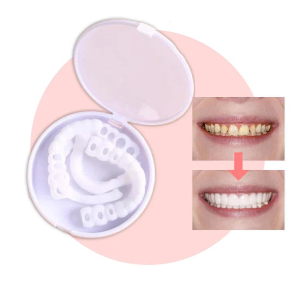 【LAST DAY SALE】Snap-on teeth™ - Always the perfect smile with these veneers